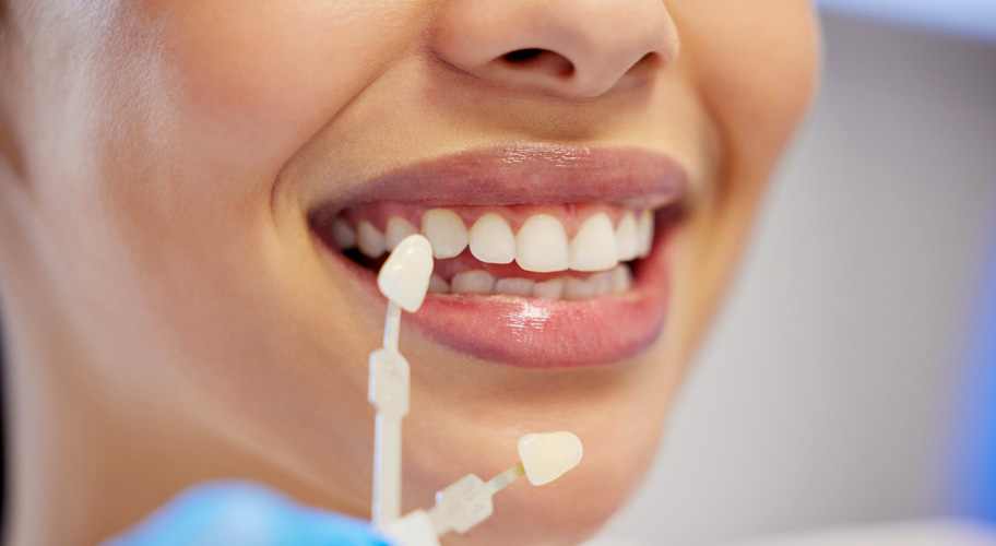 Estética dental