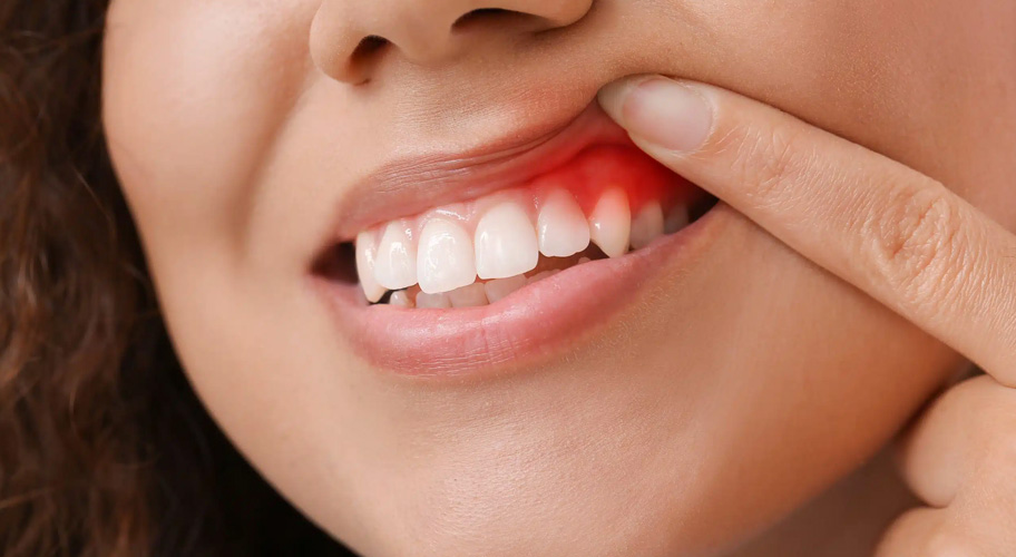 Periodoncia